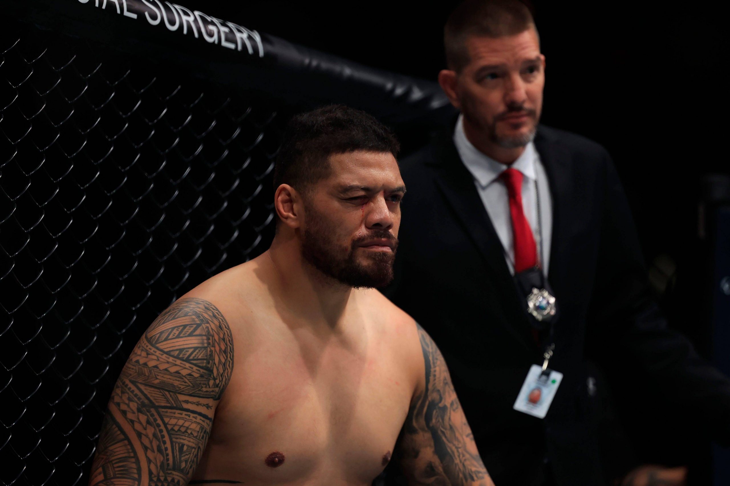 Justin Tafa after being eye poked by Austen Lane at UFC Fight Night: Emmett vs. Topuria.