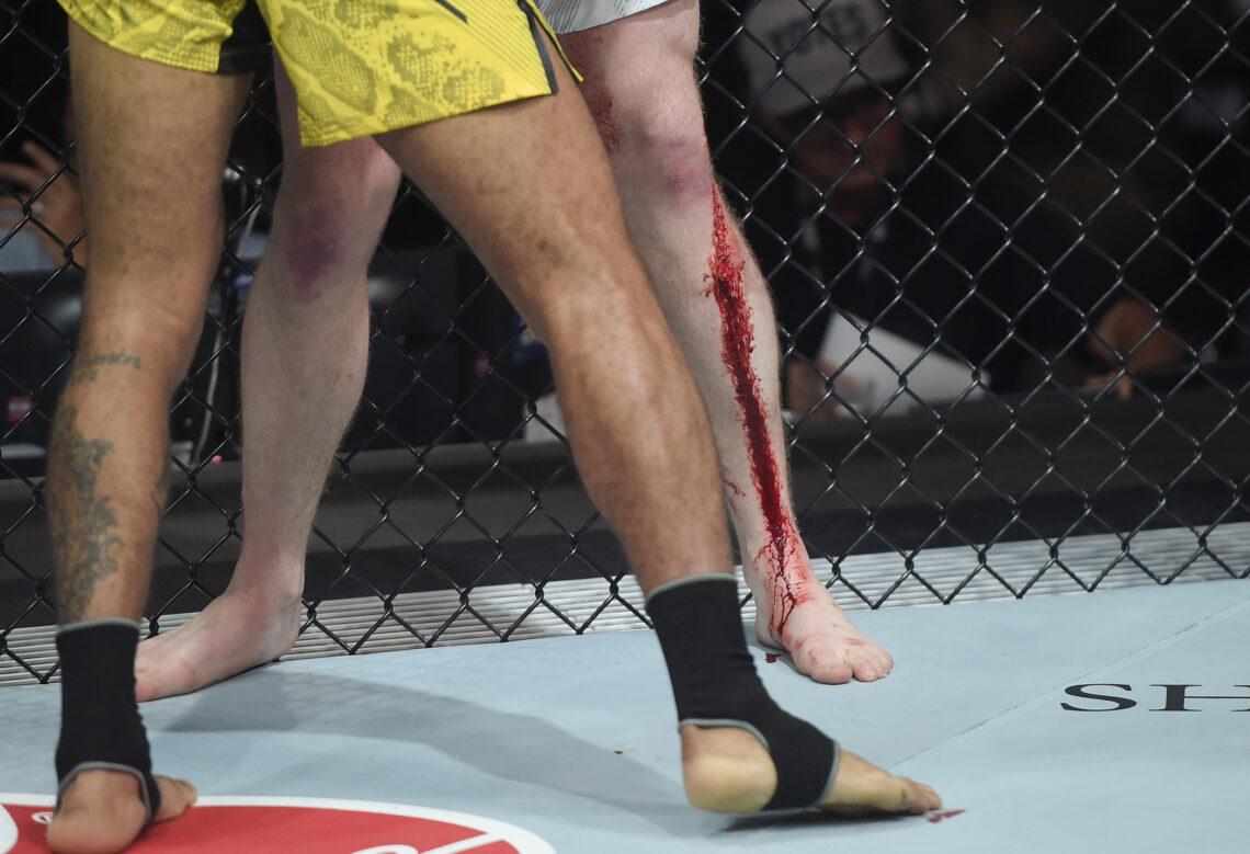 Photo by Alexandre Loureiro/Zuffa LLC via Getty Images