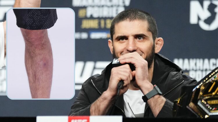 A composite image showing Islam Makhachev speaking into a UFC microphone, with a block to his right showing an injury on his left