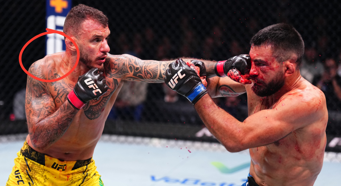 Photo shows Renato Moicano punching Benot Saint-Denis during UFC Paris, with a circle over his right shoulder, which was injured during the fight