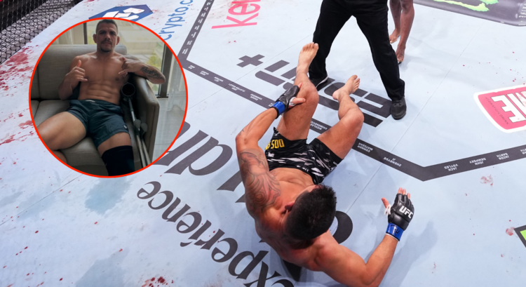 Rafael dos Anjos