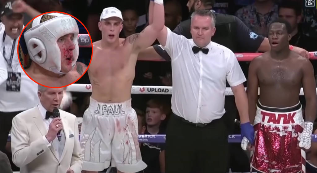 Jake Paul defeating Deji in his boxing debut. Bubble photo shows Jake Paul with his nose bloodied