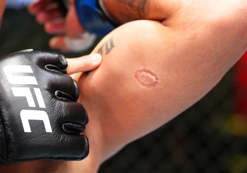 UFC Fight Night: Severino v Lima