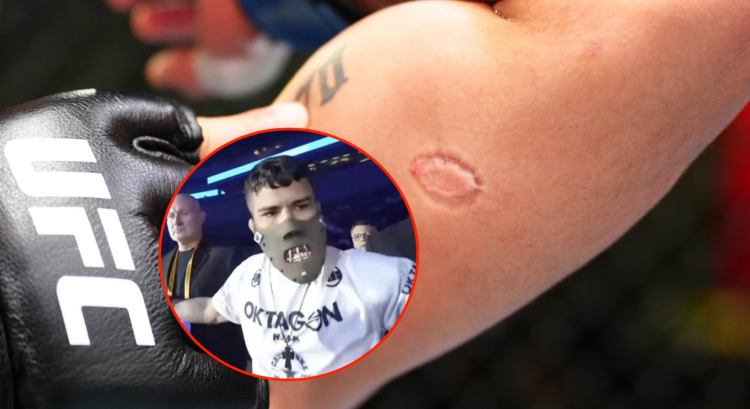 Igor Severino's bite marks, with a bubble showing him walking to the cage in a Hannibal Lecter mask