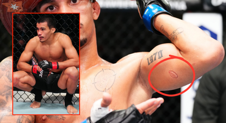 Pop out of Igor Severino and Andre Lima during and after their fight at UFC Fight Night: Ribas vs Namajunas