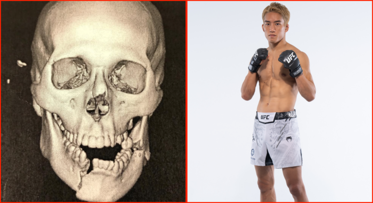 Kai Asakura (right) during his UFC 310 media day photo's