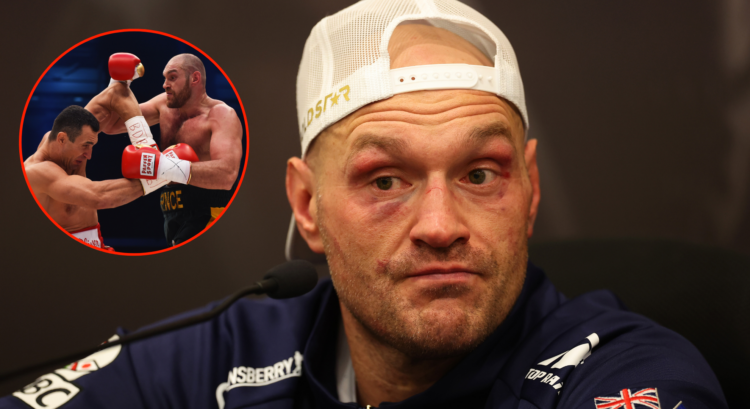 Tyson Fury