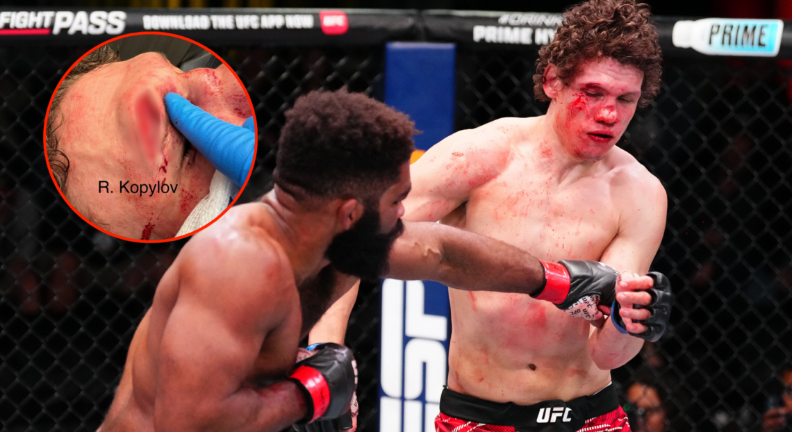 Roman Kopylov and Chris Curtis (right) during their UFC Vegas 101 fight, and Roman Kopylov (left) following the fight