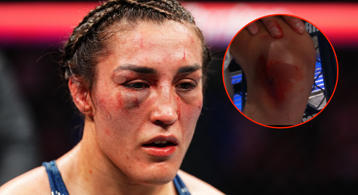 Image of Tatiana Suarez after UFC 312, inset image of Tatiana's knee on UFC 312 broadcast