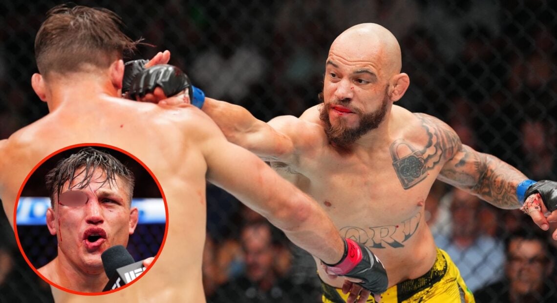 Image of Jean Silva vs Drew Dober. Inset, Dober with blurred eye