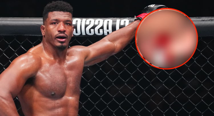 Image of Alonzo Menifield, inset image of foot injury