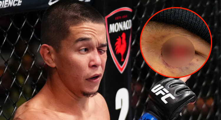 Asu Almabayev reacts after an eye poke suffered against Manel Kape.