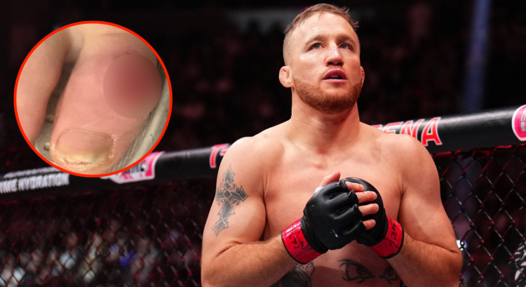 Justin Gaethje enters the cage at UFC 313, inset photo of Gaethje's toe injury.