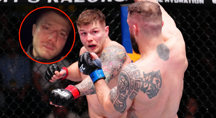 Marvin Vettori during and after his fight with Roman Dolidze at UFC Vegas 104