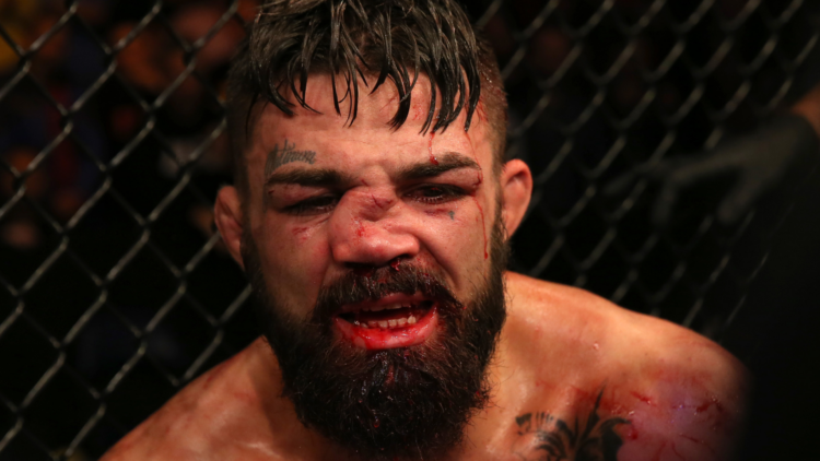 Mike Perry with a broken nose in UFC