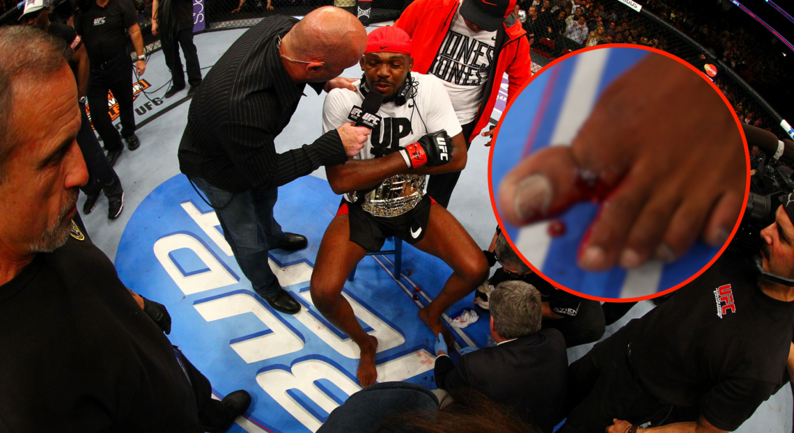 Jon Jones has his broken toe tended to while he is interviewed by Joe Rogan after winning by knockout in round one against Chael Sonnen in their li...