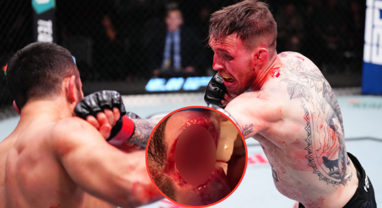 Rhys McKee punches Daniel Frunza at UFC Vegas 105, inset Frunza's lip cut.