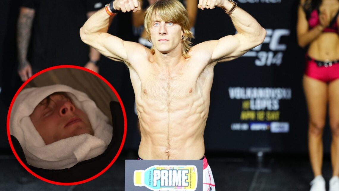 Paddy Pimblett on the scales at the UFC 314 ceremonial weigh-ins with an inset of Pimblett cutting weight whilst wrapped in towels