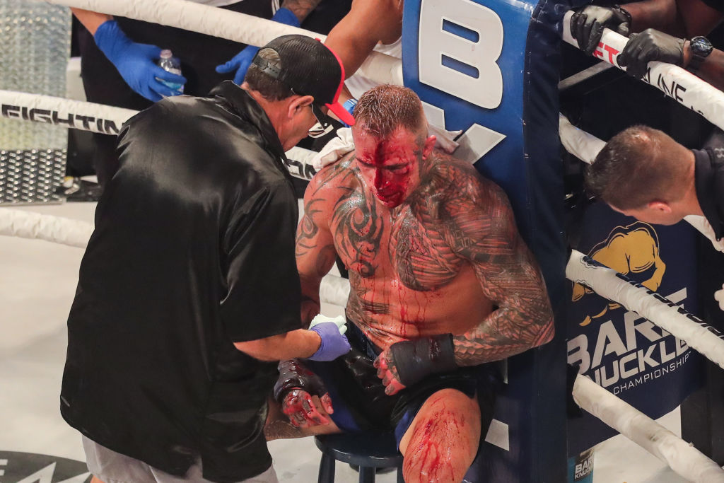 Jake Bostwick cant get his forehead to stop bleeding during his bout against Julian Lane at BKFC 18.