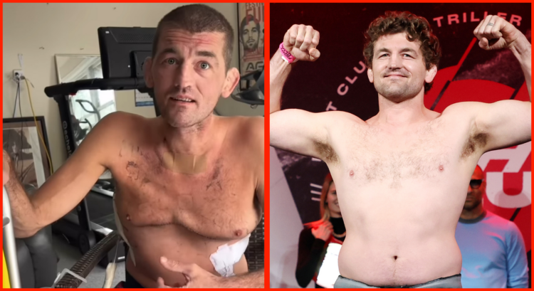 Composite image showing Ben Askren shirtless in 2025 after a double lung transplant looking gaunt, and weighing in for a fight in 2021 flexing and ...