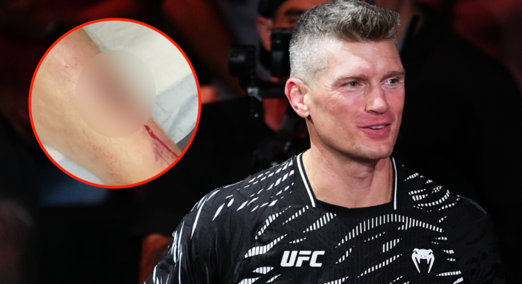 Stephen Thompson walks to the Octagon for his fight at UFC Nashville, inset a blurred image of Thompson's shin cut open