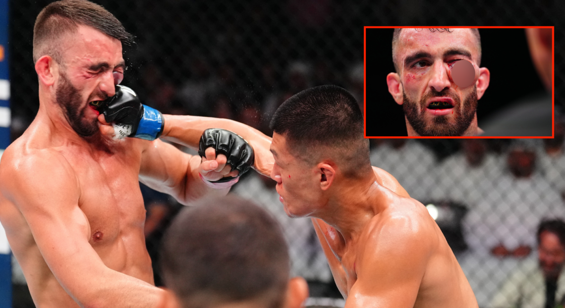 Steven Nguyen punches Mohammad Yahya during their fight at UFC Abu Dhabi, inset Yahya's eye injury blurred