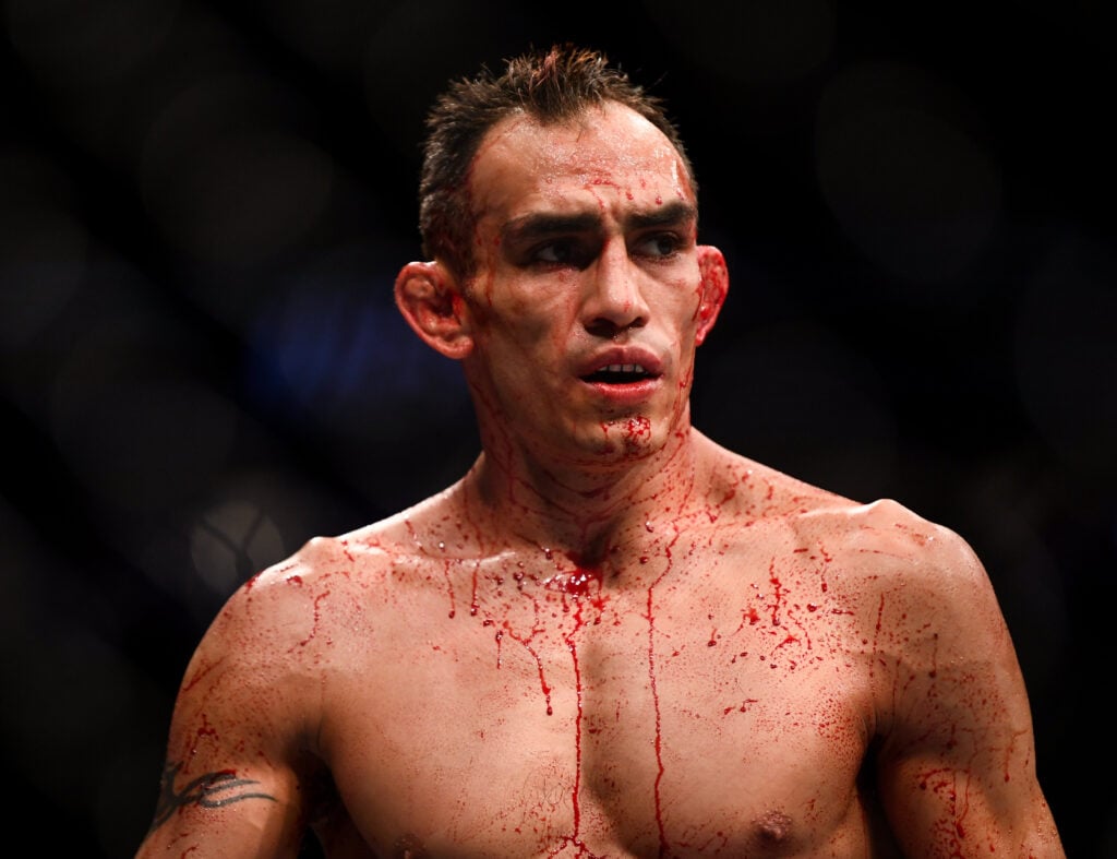 Tony Ferguson responds to health concerns as he looks to snap 8-fight losing streak in boxing debut