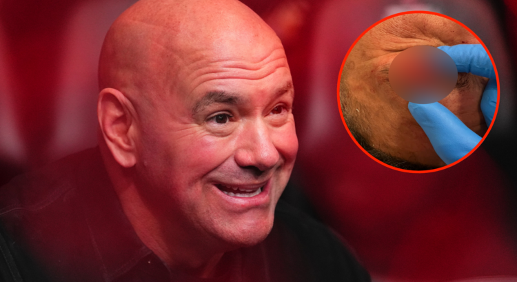 Dana White sits cageside at UFC Seattle, inset middleweight Eryk Anders's injury following UFC Vegas 109