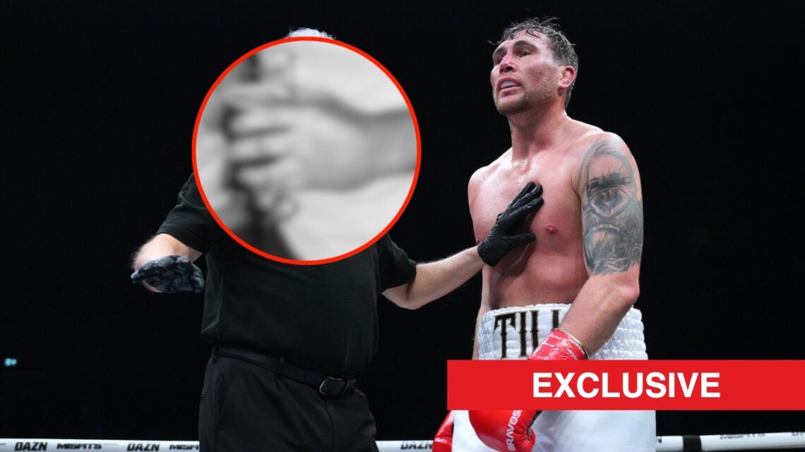 Darren Till during a boxing fight. Bubble shows a blurred photo of his hand, displaying a break