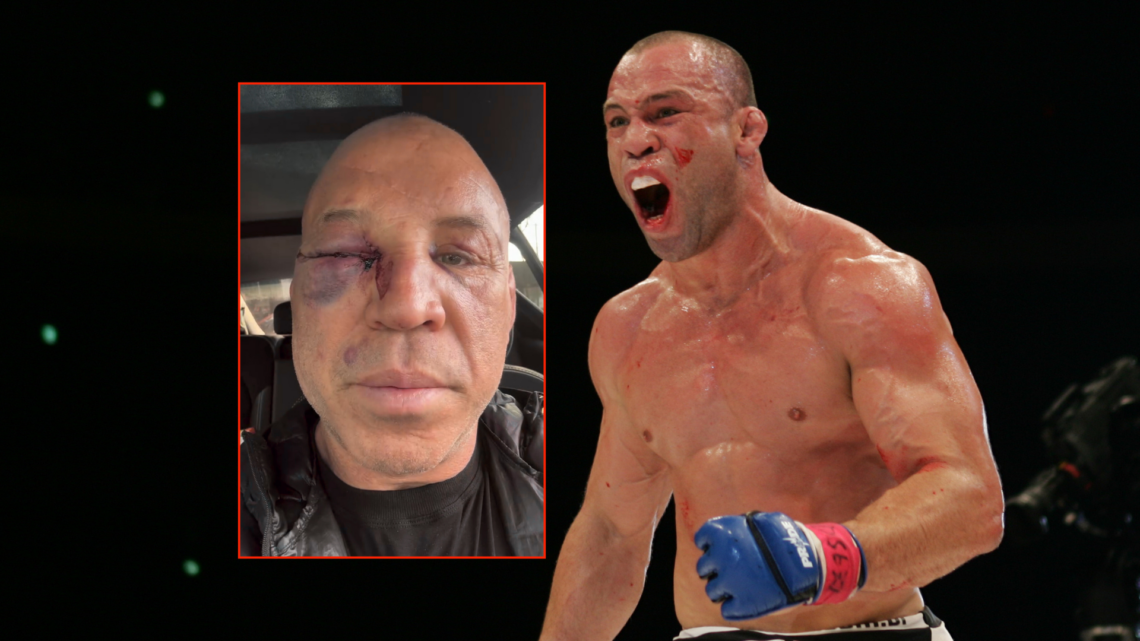 Wanderlei Silva reacts after defeating Quinton 'Rampage' Jackson, with inset of Wanderlei Silva with eye swelled shut following shock KO