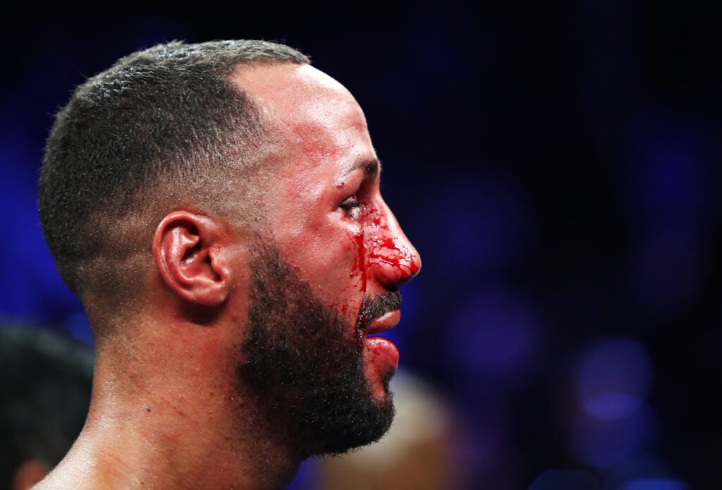 James DeGale looks on after his fight with Badou Jack