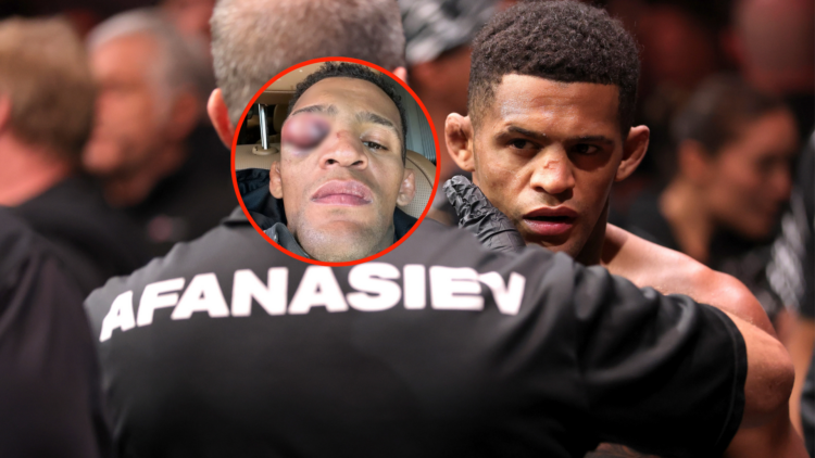 Patchy Mix being checked by official before UFC 320 fight, inset of Patchy Mix with hematoma post-fight