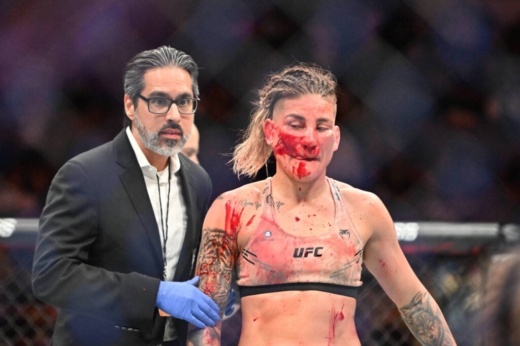 Priscila Cachoeira was left a bloody mess by Jasmine Jasudavicius at UFC 297.